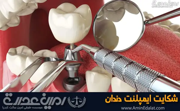 شکایت ایمپلنت دندان